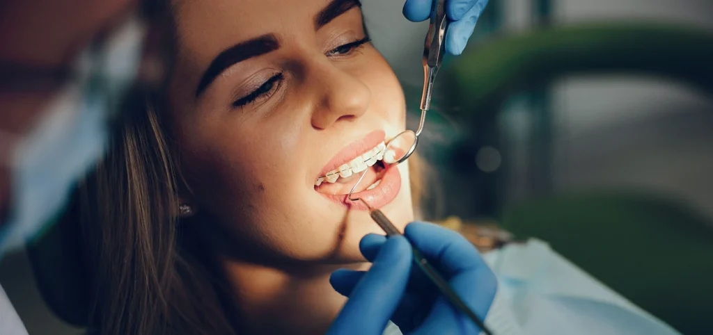 bagues dentaires classiques orthodontie gisors bagues dentaires classiques orthodontie gisors Orthodontie adulte Dr Luca MANGIARACINA - Orthodontie Gisors
