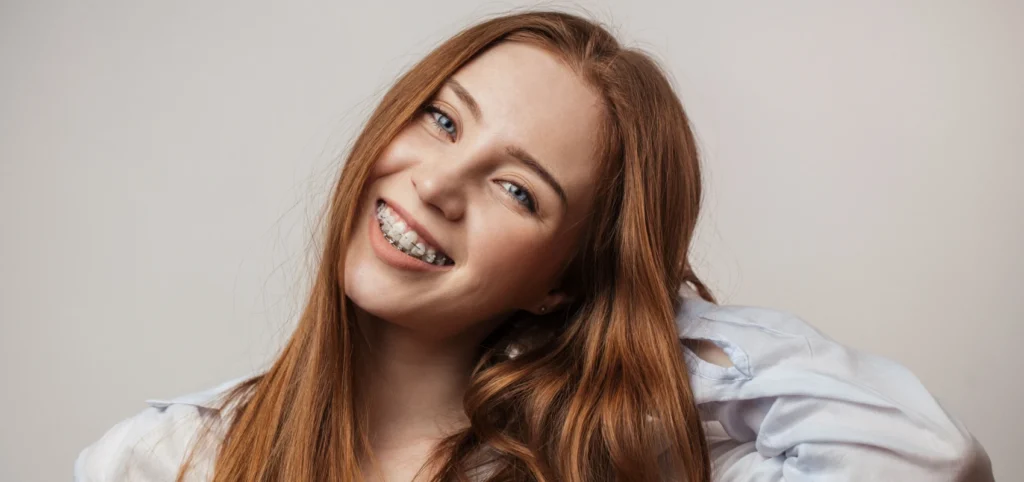 orthodontie gisors adulte orthodontie gisors adulte Orthodontie adulte Dr Luca MANGIARACINA - Orthodontie Gisors