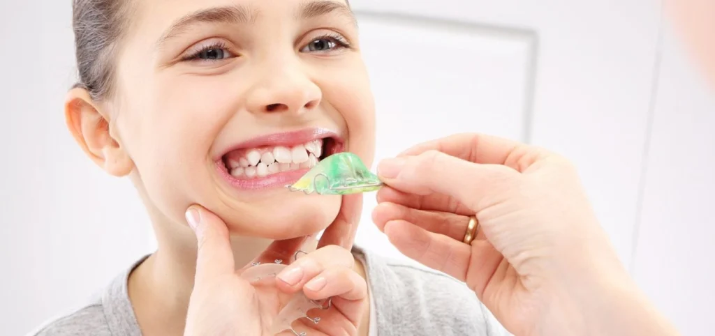 plaque palatine orthodontie enfant gisors Orthodontie enfant Dr Luca MANGIARACINA - Orthodontie Gisors
